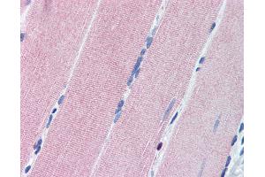Anti-PRKG1 / CGKI antibody IHC of human skeletal muscle.