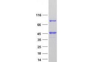 Validation with Western Blot