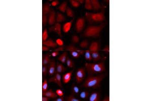 Immunofluorescence analysis of U2OS cells using PDLIM5 antibody. (PDLIM5 anticorps  (AA 317-596))