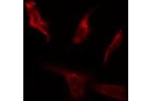 anti-AKT 1/2/3 (pTyr312), (pTyr315), (pTyr316) antibody