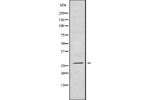 Western blot analysis NRIP3 using COLO205 whole cell lysates (NRIP3 anticorps  (C-Term))