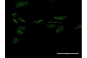 Immunofluorescence of monoclonal antibody to SP1 on HeLa cell. (SP1 anticorps  (AA 522-618))