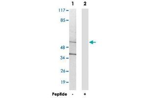 Western blot analysis of extracts from 293 cells, using CYP21A2 polyclonal antibody . (CYP21A2 anticorps)