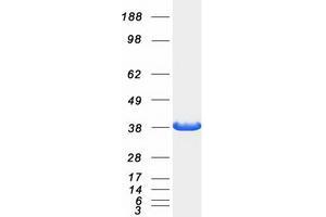 Validation with Western Blot