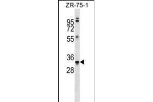MBP Antibody (Ascites) ABIN1539854 western blot analysis in ZR-75-1 cell line lysates (35 μg/lane). (MBP anticorps)