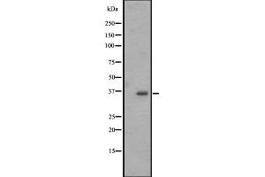 Western blot analysis of OR2M4 expression in Jurkat whole cell lysate ,The lane on the left is treated with the antigen-specific peptide. (OR2M4 anticorps)