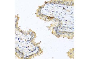 Immunohistochemistry of paraffin-embedded human prostate using DEFB121 antibody at dilution of 1:100 (40x lens).