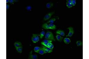 Immunofluorescence staining of MCF-7 cells with ABIN7174125 at 1:133, counter-stained with DAPI. (SIRPA anticorps  (AA 31-373))