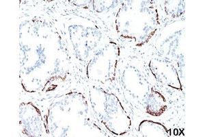 IHC staining of human prostate (10X) with HMW Cytokeratin antibody (34bE12). (KRT1 anticorps)