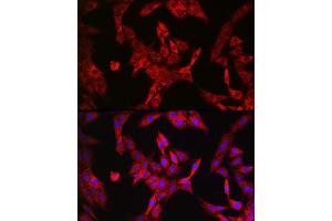 Immunofluorescence analysis of PC-12 cells using LDHA Rabbit mAb  at dilution of 1:100 (40x lens). (Lactate Dehydrogenase A anticorps)