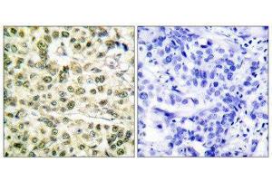 Immunohistochemistry (IHC) image for anti-Proliferating Cell Nuclear Antigen (PCNA) (Internal Region) antibody (ABIN1848734) (PCNA anticorps  (Internal Region))