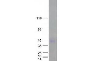 Carcinoembryonic Antigen-Related Cell Adhesion Molecule 7 (CEACAM7) protein (Myc-DYKDDDDK Tag)