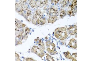 Immunohistochemistry of paraffin-embedded human stomach using PPOX antibody (ABIN5973799) at dilution of 1/100 (40x lens). (PPOX anticorps)