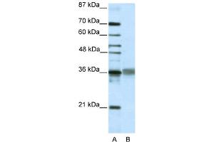 WB Suggested Anti-TLX2 Antibody Titration:  2. (TLX2 anticorps  (C-Term))