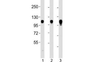 Western blot testing of Integrin alpha 7 antibody at 1:2000 dilution. (ITGA7 anticorps  (C-Term))