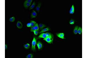 Immunofluorescent analysis of MCF-7 cells using ABIN7170092 at dilution of 1:100 and Alexa Fluor 488-congugated AffiniPure Goat Anti-Rabbit IgG(H+L)