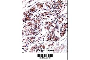 UBP1 Antibody immunohistochemistry analysis in formalin fixed and paraffin embedded human breast tissue followed by peroxidase conjugation of the secondary antibody and DAB staining. (UBP1 anticorps  (AA 266-295))
