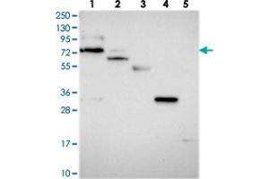 Western blot analysis of Lane 1: RT-4, Lane 2: U-251 MG, Lane 3: Human Plasma, Lane 4: Liver, Lane 5: Tonsil with ARHGAP44 polyclonal antibody . (ARHGAP44 anticorps)
