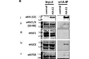 Endogenous KLC2 co-immunoprecipitates with E2.
