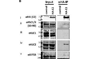 Endogenous KLC2 co-immunoprecipitates with E2. (KLC1 anticorps)