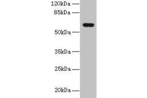 Western blot All lanes: KATNAL2 antibody at 1 μg/mL + U251 whole cell lysate Secondary Goat polyclonal to rabbit IgG at 1/10000 dilution Predicted band size: 62, 53 kDa Observed band size: 62 kDa (KATNAL2 anticorps  (AA 18-307))