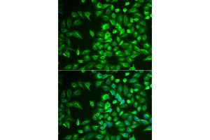 Immunofluorescence analysis of U2OS cells using LRAT antibody (ABIN6132019, ABIN6143313, ABIN6143316 and ABIN6222345). (LRAT anticorps  (AA 1-194))