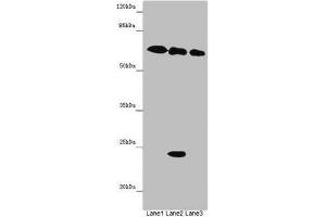 Western blot All lanes: TOX3 antibody at 9 μg/mL Lane 1: Mouse heart tissue Lane 2: Mouse spleen tissue Lane 3: Mouse brain tissue Secondary Goat polyclonal to rabbit IgG at 1/10000 dilution Predicted band size: 63 kDa Observed band size: 63, 24 kDa (TOX3 anticorps  (AA 8-305))