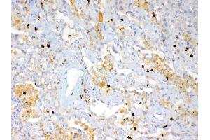 IHC analysis of Psoriasin using anti-Psoriasin antibody .