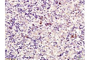 anti-Mkk7/Erk7 (AA 301-419) antibody