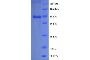 SDS-PAGE (SDS) image for Prefoldin Subunit 5 (PFDN5) (AA 2-154) protein (GST tag) (ABIN5712149)