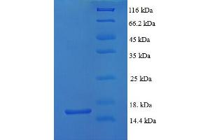 SDS-PAGE (SDS) image for Growth Differentiation Factor 5 (GDF5) (AA 376-495) protein (His tag) (ABIN5709563)