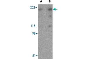 Western blot analysis of RTN4 in human brain tissue lysate with RTN4 polyclonal antibody  at (A) 0. (Reticulon 4 anticorps  (Internal Region))