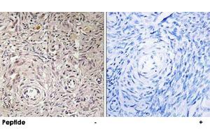 Immunohistochemistry analysis of paraffin-embedded human ovary tissue using GCNT7 polyclonal antibody .