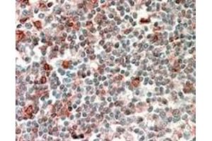 Image no. 3 for anti-Neutrophil Cytosolic Factor 4, 40kDa (NCF4) (Internal Region) antibody (ABIN374770) (NCF4 anticorps  (Internal Region))