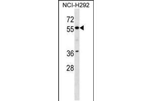 Western blot analysis in NCI-H292 cell line lysates (35ug/lane). (ZNF512 anticorps  (N-Term))
