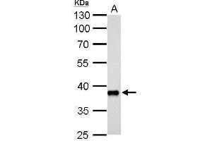 WB Image AKR1C3 antibody [C2C3], C-term detects AKR1C3 protein by Western blot analysis.