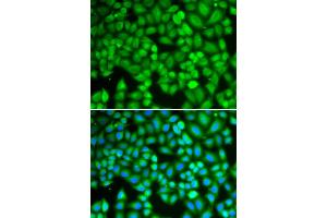 Immunofluorescence analysis of U2OS cells using WAS antibody (ABIN5970366). (WASP anticorps)