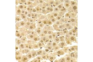 Immunohistochemistry of paraffin-embedded rat liver using CDK4 antibody at dilution of 1:100 (x400 lens). (CDK4 anticorps)