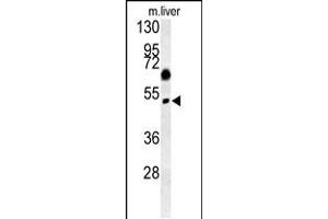 Western blot analysis in mouse liver tissue lysates (15ug/lane).