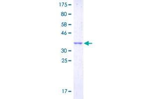 Image no. 1 for G Protein-Coupled Receptor 132 (GPR132) (AA 281-380) protein (GST tag) (ABIN2565113)