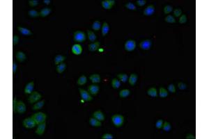 Immunofluorescent analysis of PC-3 cells using ABIN7146178 at dilution of 1:100 and Alexa Fluor 488-congugated AffiniPure Goat Anti-Rabbit IgG(H+L) (ZMPSTE24 anticorps  (AA 217-347))