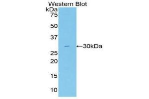 Detection of Recombinant Gallus, Human using Polyclonal Antibody to Fatty Acid Synthase (FASN)