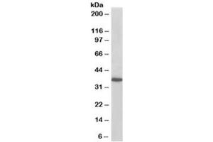 Western blot testing of A431 lysate with PDLIM4 antibody at 0. (PDLIM4 anticorps)