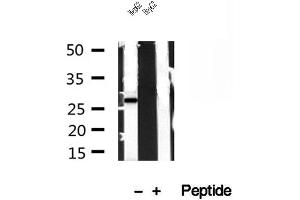 Western blot analysis of extracts of HepG2 cells, using TPI1 antibody. (TPI1 anticorps  (C-Term))