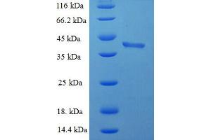 SDS-PAGE (SDS) image for BH3 Interacting Domain Death Agonist (BID) (AA 1-195), (full length) protein (His-SUMO Tag) (ABIN5709137)