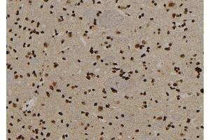 ABIN6279896 at 1/100 staining Rat brain tissue by IHC-P. (USP29 anticorps)