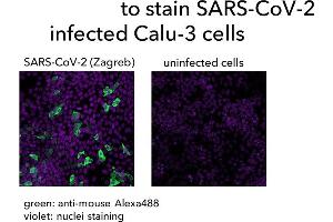 anti-SARS-CoV-2 Nucleocapsid (SARS-CoV-2 N) (Whole Molecule) antibody