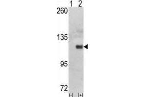 Western Blotting (WB) image for anti-Hexokinase 1 (HK1) antibody (ABIN3003712) (Hexokinase 1 anticorps)