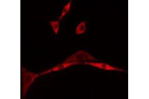 ABIN6275497 staining A549 cells by IF/ICC. (ARHGEF16 anticorps  (Internal Region))