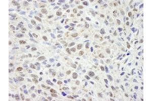 Immunohistochemistry (IHC) image for anti-Cell Division Cycle and Apoptosis Regulator 1 (CCAR1) (AA 1-50) antibody (ABIN7448463) (CCAR1 anticorps  (AA 1-50))